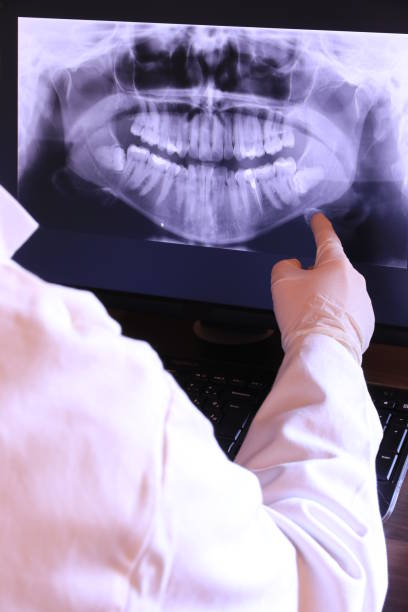 Best Emergency Gum Treatment in Northport, AL