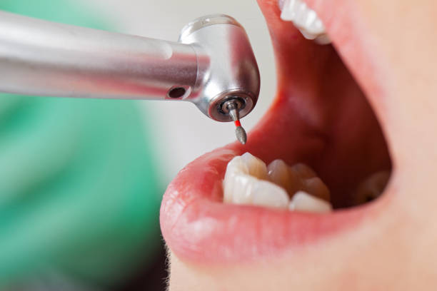 Best Pediatric Emergency Dentist in Northport, AL